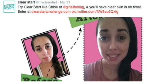 Dermalogica 'Clear Start Challenge' Contest